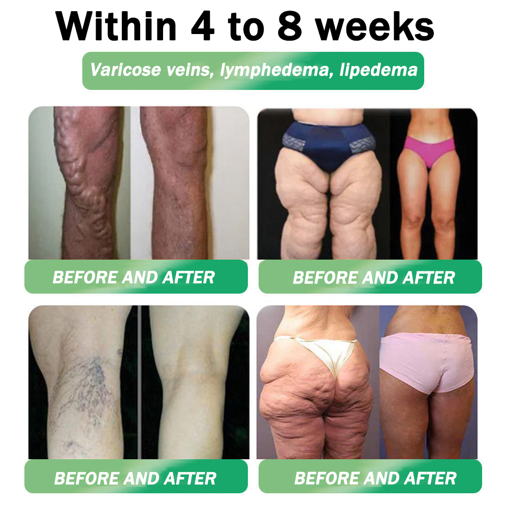 🇺🇸𝑶𝒇𝒇𝒊𝒄𝒊𝒂𝒍 𝑺𝒕𝒐𝒓𝒆|Rekulo® 𝐍𝐀𝐃+ 𝐆𝐋𝐏-𝟏 Pro ALL-IN-ONE Fit&Vital 𝐎𝐫𝐚𝐥 𝐋𝐢𝐪𝐮𝐢𝐝 (𝐉𝐮𝐬𝐭 𝐨𝐧𝐜𝐞 𝐚 𝐝𝐚𝐲, 𝐯𝐢𝐬𝐢𝐛𝐥𝐞 𝐜𝐡𝐚𝐧𝐠𝐞𝐬 𝐢𝐧 𝟕 𝐝𝐚𝐲𝐬） ✅ 𝐅𝐨𝐫 𝐨𝐛𝐞𝐬𝐢𝐭𝐲, 𝐜𝐚𝐫𝐝𝐢𝐨𝐯𝐚𝐬𝐜𝐮𝐥𝐚𝐫 𝐡𝐞𝐚𝐥𝐭𝐡, 𝐝𝐢𝐚𝐛𝐞𝐭𝐞𝐬, 𝐬𝐥𝐞𝐞𝐩 𝐚𝐩𝐧𝐞𝐚, 𝐆𝐮𝐭 𝐇𝐞𝐚𝐥𝐭𝐡, 𝐣𝐨𝐢𝐧𝐭 𝐢𝐬𝐬𝐮𝐞𝐬, 𝐚𝐧𝐝 𝐦𝐨𝐫𝐞