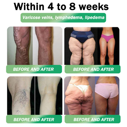 🇺🇸𝑶𝒇𝒇𝒊𝒄𝒊𝒂𝒍 𝑺𝒕𝒐𝒓𝒆|Rekulo® 𝐍𝐀𝐃+ 𝐆𝐋𝐏-𝟏 Pro ALL-IN-ONE Fit&Vital 𝐎𝐫𝐚𝐥 𝐋𝐢𝐪𝐮𝐢𝐝 (𝐉𝐮𝐬𝐭 𝐨𝐧𝐜𝐞 𝐚 𝐝𝐚𝐲, 𝐯𝐢𝐬𝐢𝐛𝐥𝐞 𝐜𝐡𝐚𝐧𝐠𝐞𝐬 𝐢𝐧 𝟕 𝐝𝐚𝐲𝐬） ✅ 𝐅𝐨𝐫 𝐨𝐛𝐞𝐬𝐢𝐭𝐲, 𝐜𝐚𝐫𝐝𝐢𝐨𝐯𝐚𝐬𝐜𝐮𝐥𝐚𝐫 𝐡𝐞𝐚𝐥𝐭𝐡, 𝐝𝐢𝐚𝐛𝐞𝐭𝐞𝐬, 𝐬𝐥𝐞𝐞𝐩 𝐚𝐩𝐧𝐞𝐚, 𝐆𝐮𝐭 𝐇𝐞𝐚𝐥𝐭𝐡, 𝐣𝐨𝐢𝐧𝐭 𝐢𝐬𝐬𝐮𝐞𝐬, 𝐚𝐧𝐝 𝐦𝐨𝐫𝐞