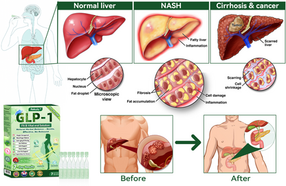 🇬🇧𝑶𝒇𝒇𝒊𝒄𝒊𝒂𝒍 𝑺𝒕𝒐𝒓𝒆|Rekulo® 𝐍𝐀𝐃+ 𝐆𝐋𝐏-𝟏 Pro ALL-IN-ONE Fit&Vital 𝐎𝐫𝐚𝐥 𝐋𝐢𝐪𝐮𝐢𝐝 (𝐉𝐮𝐬𝐭 𝐨𝐧𝐜𝐞 𝐚 𝐝𝐚𝐲, 𝐯𝐢𝐬𝐢𝐛𝐥𝐞 𝐜𝐡𝐚𝐧𝐠𝐞𝐬 𝐢𝐧 𝟕 𝐝𝐚𝐲𝐬） ✅ 𝐅𝐨𝐫 𝐨𝐛𝐞𝐬𝐢𝐭𝐲, 𝐜𝐚𝐫𝐝𝐢𝐨𝐯𝐚𝐬𝐜𝐮𝐥𝐚𝐫 𝐡𝐞𝐚𝐥𝐭𝐡, 𝐝𝐢𝐚𝐛𝐞𝐭𝐞𝐬, 𝐬𝐥𝐞𝐞𝐩 𝐚𝐩𝐧𝐞𝐚, 𝐆𝐮𝐭 𝐇𝐞𝐚𝐥𝐭𝐡, 𝐣𝐨𝐢𝐧𝐭 𝐢𝐬𝐬𝐮𝐞𝐬, 𝐚𝐧𝐝 𝐦𝐨𝐫𝐞