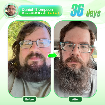 🇬🇧𝑶𝒇𝒇𝒊𝒄𝒊𝒂𝒍 𝑺𝒕𝒐𝒓𝒆|Rekulo® 𝐍𝐀𝐃+ 𝐆𝐋𝐏-𝟏 Pro ALL-IN-ONE Fit&Vital 𝐎𝐫𝐚𝐥 𝐋𝐢𝐪𝐮𝐢𝐝 (𝐉𝐮𝐬𝐭 𝐨𝐧𝐜𝐞 𝐚 𝐝𝐚𝐲, 𝐯𝐢𝐬𝐢𝐛𝐥𝐞 𝐜𝐡𝐚𝐧𝐠𝐞𝐬 𝐢𝐧 𝟕 𝐝𝐚𝐲𝐬） ✅ 𝐅𝐨𝐫 𝐨𝐛𝐞𝐬𝐢𝐭𝐲, 𝐜𝐚𝐫𝐝𝐢𝐨𝐯𝐚𝐬𝐜𝐮𝐥𝐚𝐫 𝐡𝐞𝐚𝐥𝐭𝐡, 𝐝𝐢𝐚𝐛𝐞𝐭𝐞𝐬, 𝐬𝐥𝐞𝐞𝐩 𝐚𝐩𝐧𝐞𝐚, 𝐆𝐮𝐭 𝐇𝐞𝐚𝐥𝐭𝐡, 𝐣𝐨𝐢𝐧𝐭 𝐢𝐬𝐬𝐮𝐞𝐬, 𝐚𝐧𝐝 𝐦𝐨𝐫𝐞